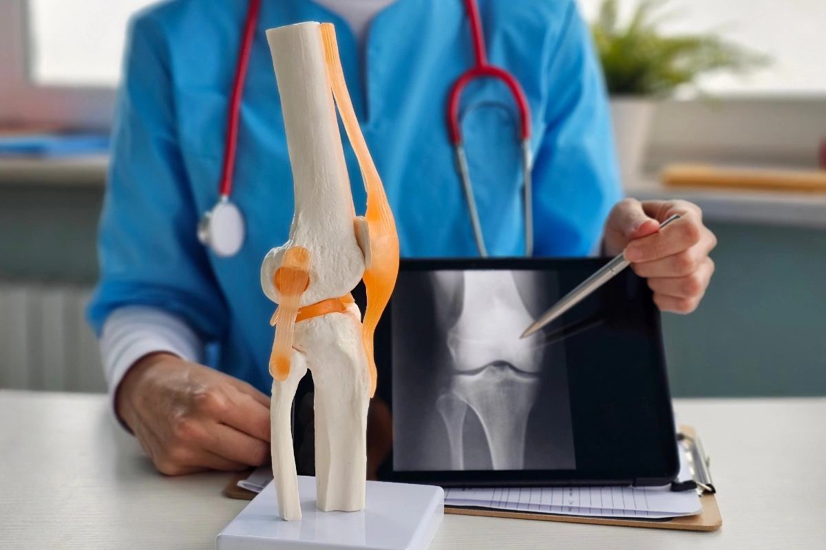 Lekár ukazuje na rtg snímku kolena pri anatomickom modeli kĺbu.