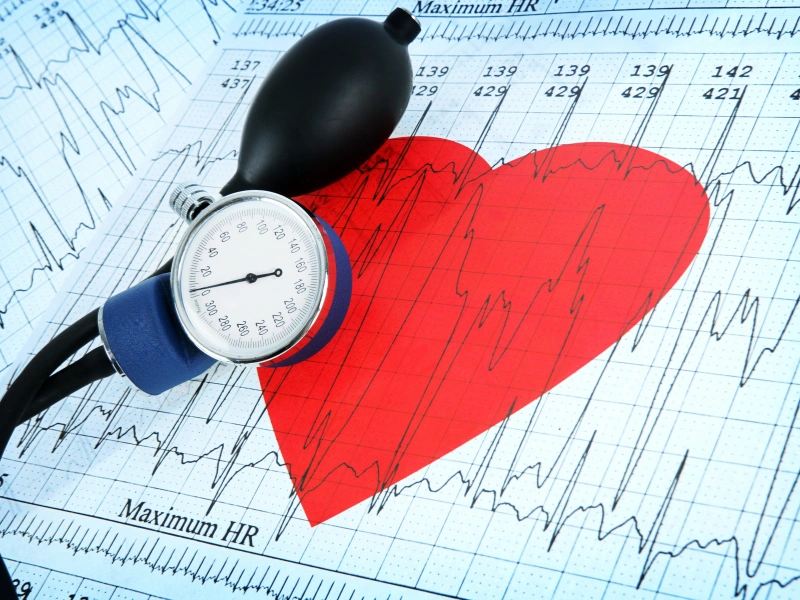 Mechanický tlakomer položený na papieri s EKG záznamom a červeným symbolom srdca.